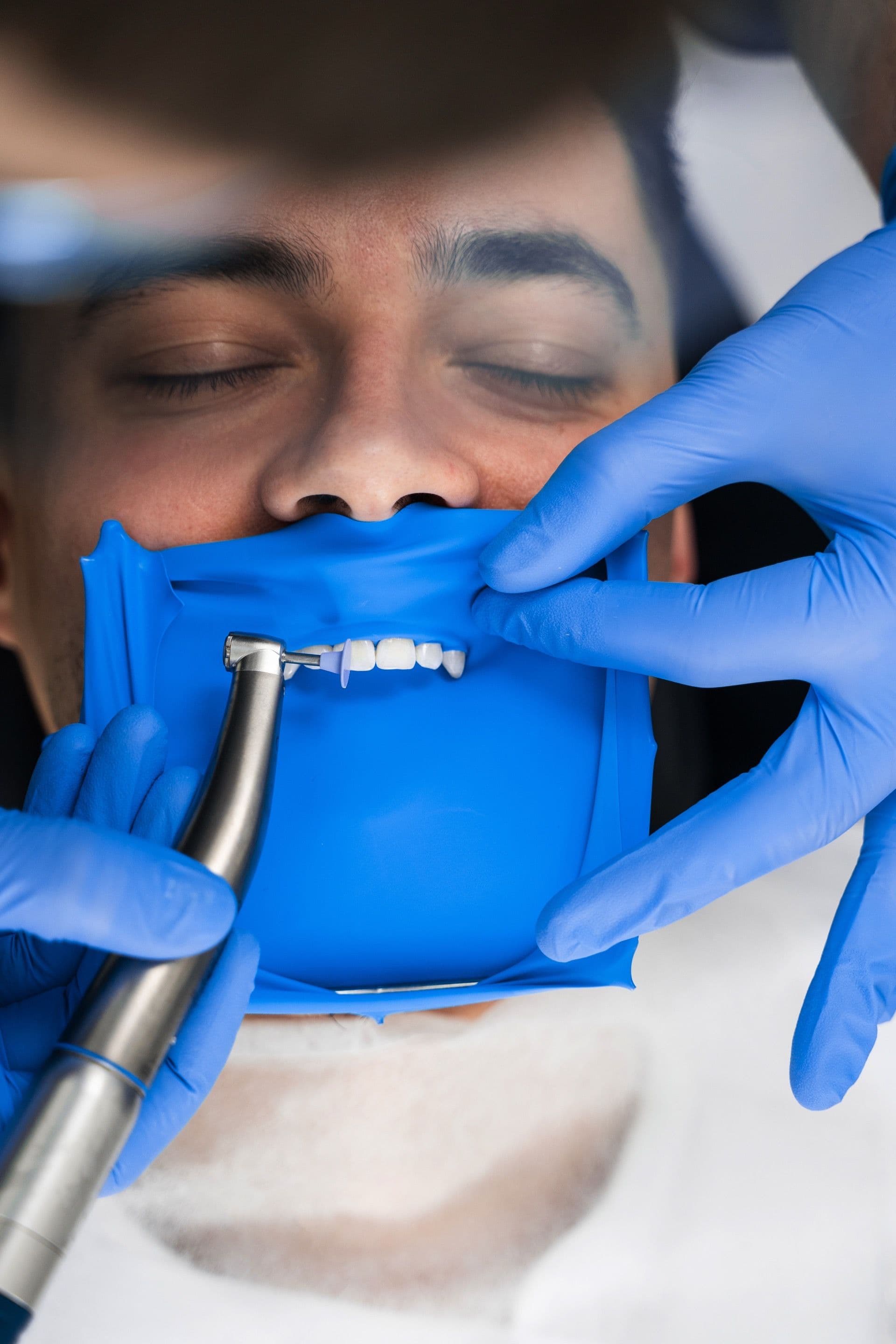 Резиновая штука у стоматолога для изоляции: фото коффердама