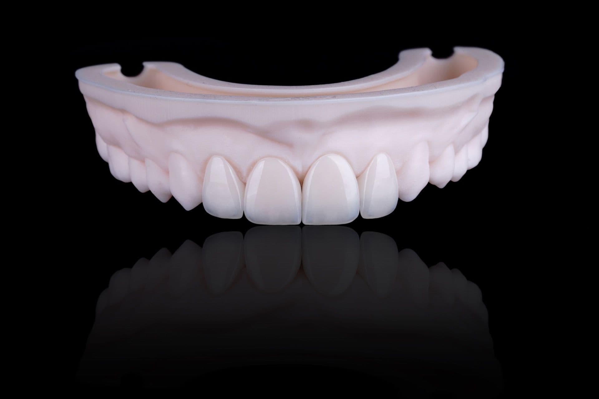 Керамические виниры на макете.